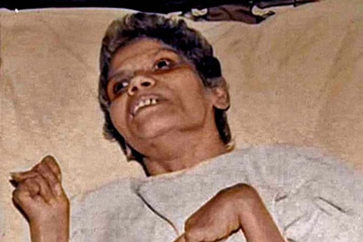 Web-Exclusive-Aruna-Shanbaug