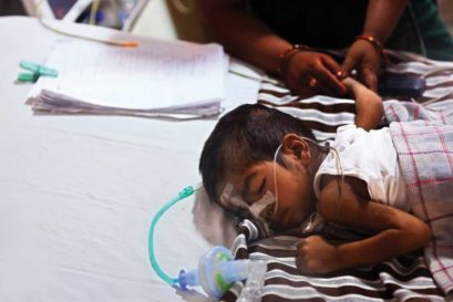 A boy on life support in the neonatal intensive care unit of the hospital