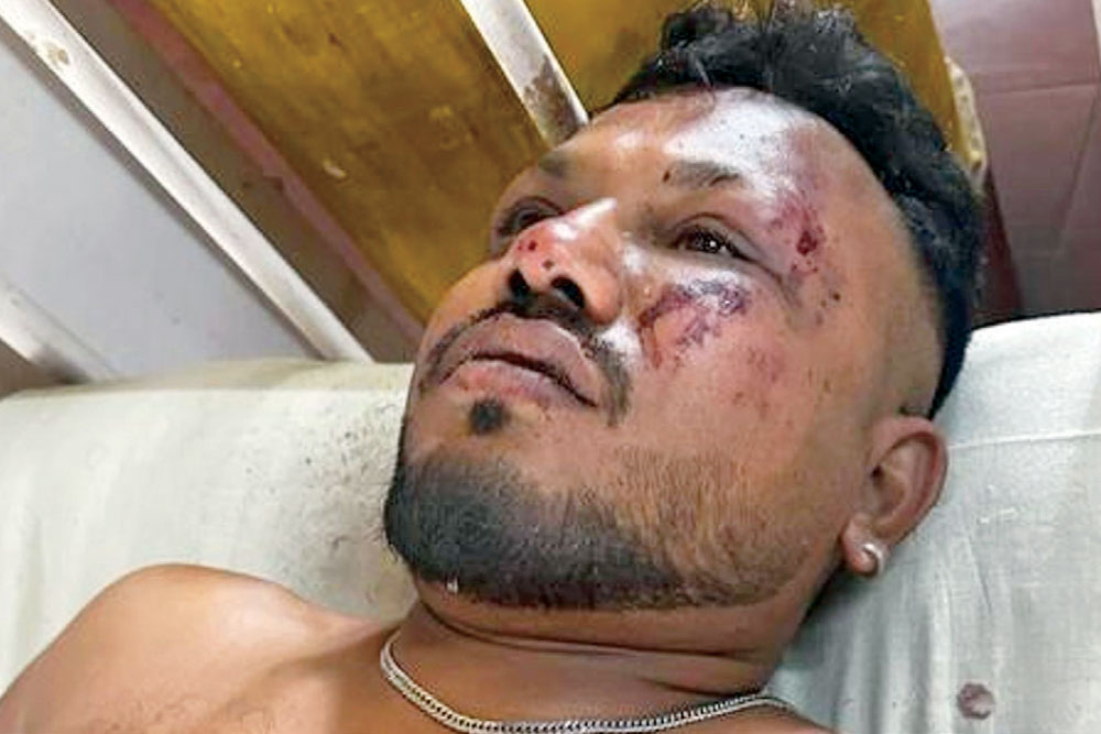 Vishwas Kumar Ramesh, the lone survivor of the crash 